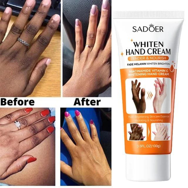 Last Day Of Discount 🔥 Sadoer Whitening Cream